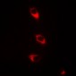 Anti-CaMK2 beta Antibody